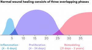 The Specifics of Inflammation | HFE Blog